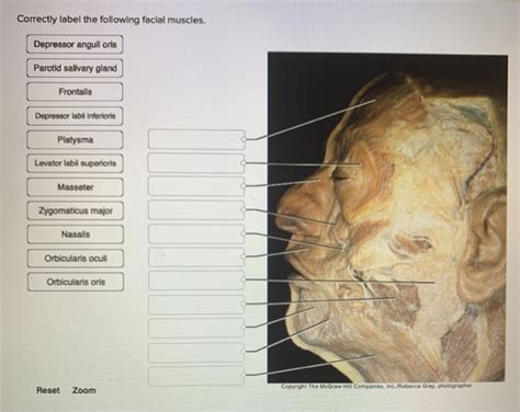 Solved Select The Correct Label And Characteristic For Chegg