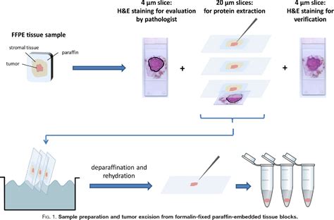 Figure From Quantification Of Her By Targeted Mass Spectrometry In