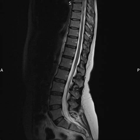 Journal Of Brown Hospital Medicine On Twitter A 50 Year Old Woman