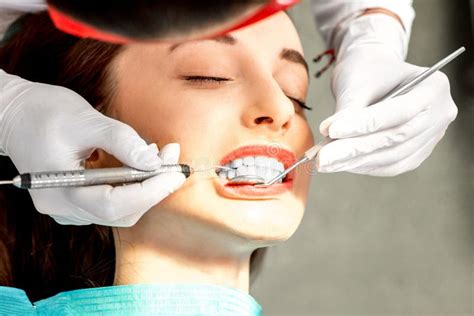 Limpeza Profissional Dos Dentes Foto De Stock Imagem De Mulheres