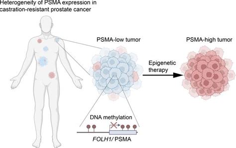 JCI Insight Reversible Epigenetic Alterations Mediate PSMA Expression