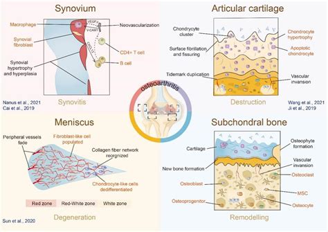 我院苏佳灿教授团队在生物学一区期刊Cell Proliferation上发表了关于单细胞RNA测序技术在骨关节炎运用的综述 上海大学转化医学研究院