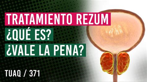 Pr Stata Lo Que Necesitas Saber Sobre El Sistema Rezum Y Sus