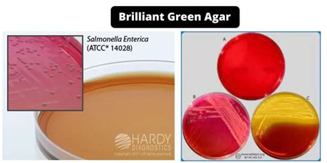 Brilliant Green Agar Composition Principle Preparation Results