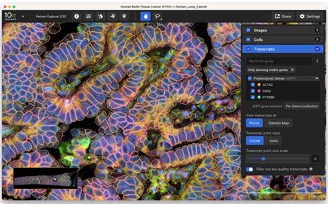 Optimizing Your Spatial Transcriptomics Research With Visium HD And