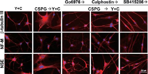 Figure From A Rock Inhibitor Blocks The Inhibitory Effect Of