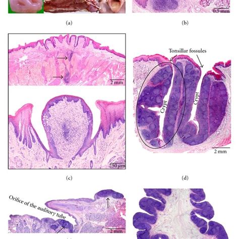 Pharyngeal Tonsil Histology