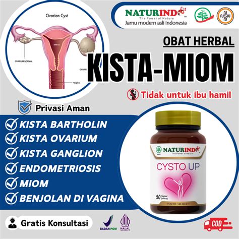 Jual Obat Kista Ovarium Bartholin Miom Herbal Kista Ganglion Tumor