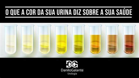 O QUE A COR DA SUA URINA DIZ SOBRE A SUA SAÚDE INFECÇÃO URINÁRIA