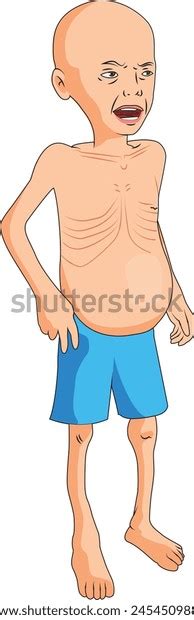 Child Suffering Malnutrition Stock Vector (Royalty Free) 2454509883 | Shutterstock