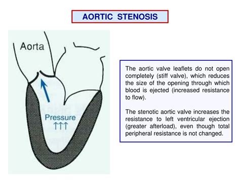 Ppt Valve Defects Cardiac Cycle Powerpoint Presentation Free