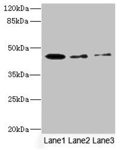 Anti Sigirr Antibody Products Biocompare