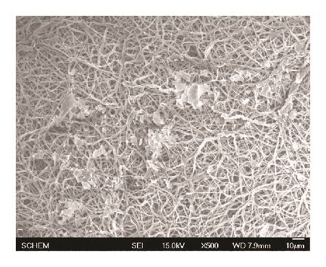 Sem Morphology Of Platelets Adhered On Electrospun Pcl Pu A And