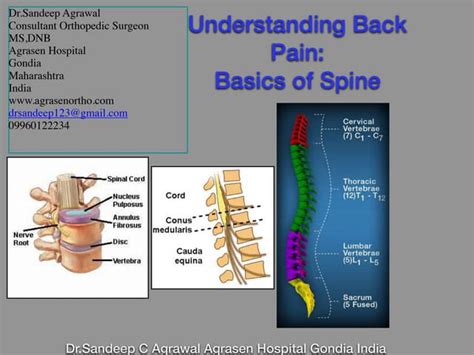 Understanding Back Pain Basics Of Spine Drsandeep C Agrawal Agrasen