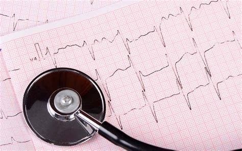 Qué es y para que sirve un Electrocardiograma Psicoténico Aravaca