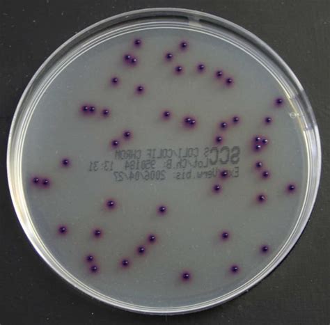 Thermo Scientific Brilliance E Coli Coliform Selective Agar