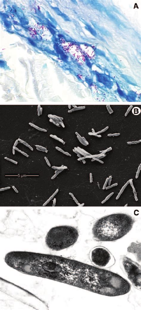 Morphology Of M Leprae A M Leprae Is Weakly Acid Fast But When Download Scientific