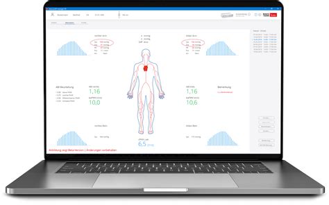 Das Boso Abi System Zuverl Ssige Erkennung Von Arteriosklerose Bzw