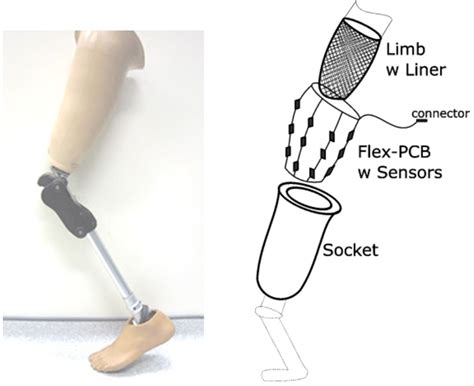 Schematic Principle Of Pressure Mapping Enhanced Lower Limb Prosthesis Download Scientific