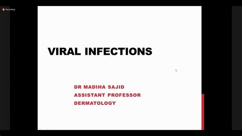 Viral Infections Dermatology YouTube