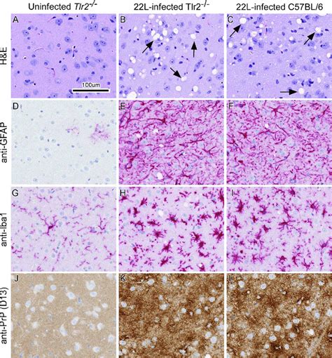 Representative Neuropathology And Immunohistochemical Assessment Of