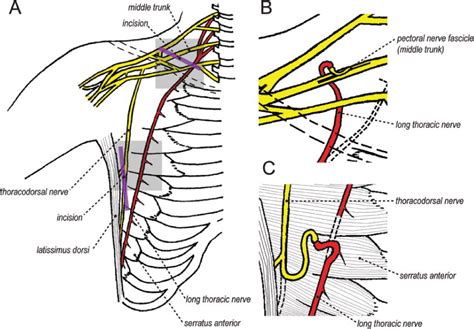 Long Thoracic Nerve Palsy