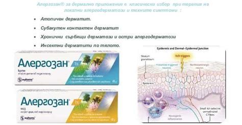Алергозан – лечебни свойства и приложения - Лекар.БГ