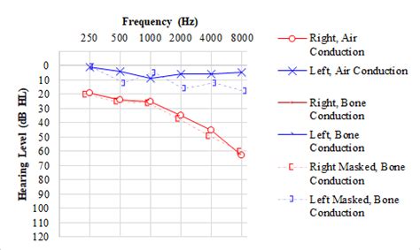 Audiogram Interpretation Treatment Management Point Of Care