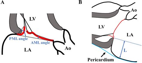 Differences In Clinical And Echocardiographic Features And Outcomes