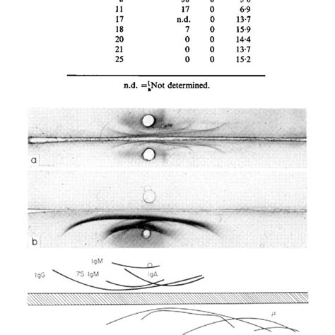 Immunoelectrophoresis Of Normal Adult Plasma Upper Well And Normal Download Scientific