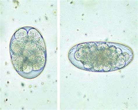 Large Parasite Identification Flashcards Quizlet