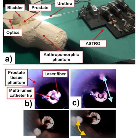 Actuation Assessment Test With The Anthropomorphic Phantom A Download Scientific Diagram