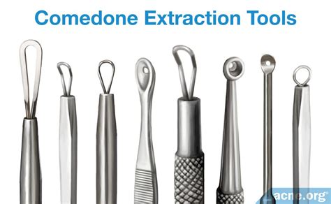 What Is Comedone Extraction, and Should You Do It? - Acne.org