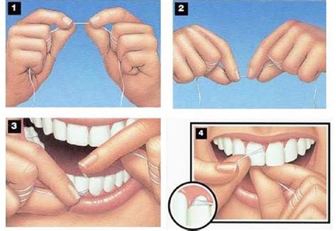 Chỉ nha khoa mua ở đâu Loại nào tốt Cách sử dụng ra sao