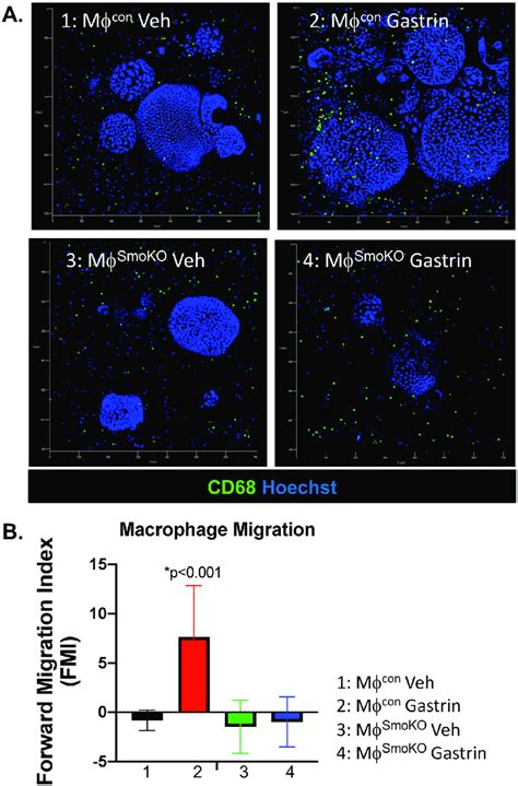 Macrophage Migration In An Organoid Macrophage Co Culture Model A