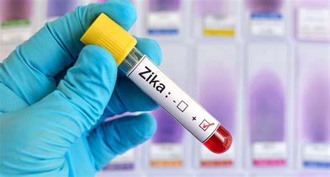 Científicos Argentinos Hicieron Un Importante Descubrimiento Sobre El Virus Del Zika