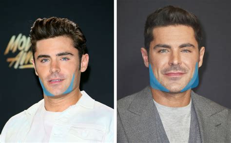 Zac Efron Révèle Quil A Lutté Contre La Dépression Après Avoir Atteint