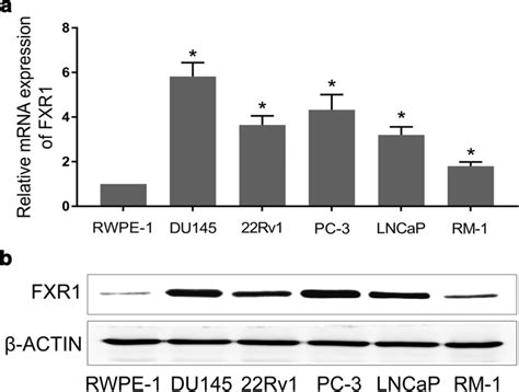 Fxr Is Upregulated In Prostate Cancer Cell Lines The Mrna A And