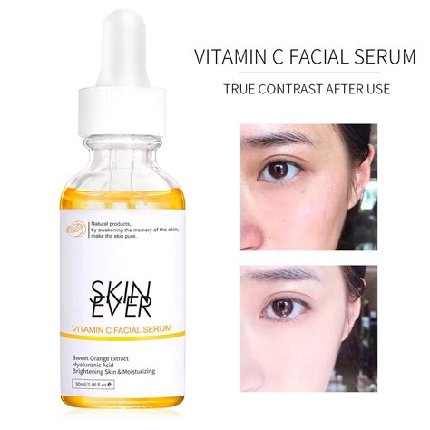 Skin Ever Vitamin C Whitening Facial Serum 30ml Shopee Malaysia