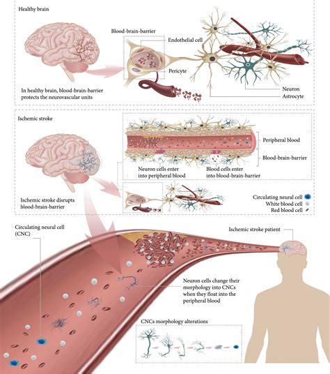 Single Cell Microwell Platform Reveals Circulating Neural Cells As A