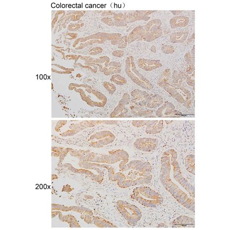 Solarbio K111261P Anti GPR42 Polyclonal Antibody 试剂仪器耗材