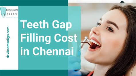 Best Teeth Gap Filling Cost in Chennai | 100% Perfect Smile