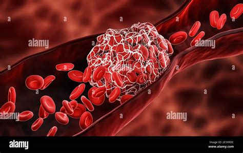 Sangue Coagulato Immagini E Fotos Stock Alamy