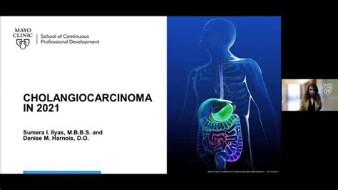 Cholangiocarcinoma In 2021