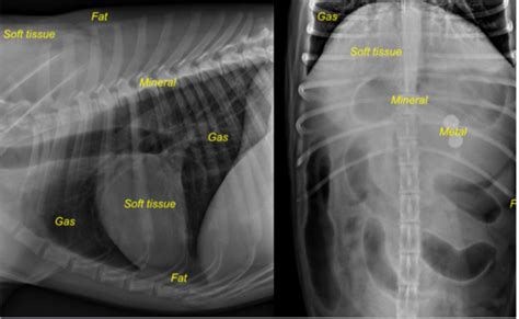 Abdominal Radiographs Flashcards Quizlet