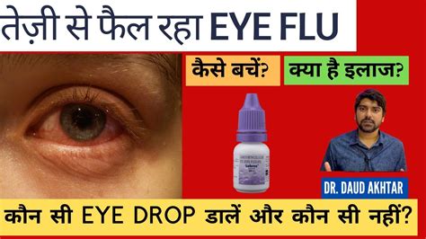 Eye Flu हो जाए तो क्या करें और कैसे बचें Viral Conjunctivitis Treatment In Hindi Youtube