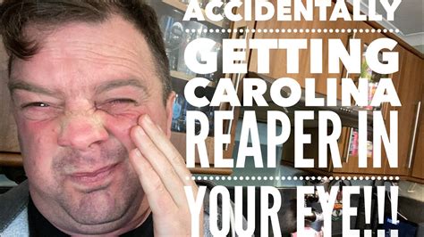 Man Gets Carolina Reaper In Eye Chilli Wizards Carolina Reaper