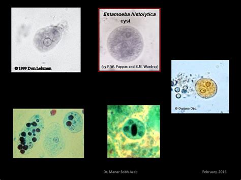 Morphology Trophozoite Pre Cyst Cyst Dr Manar Sobh Azab Ppt Download