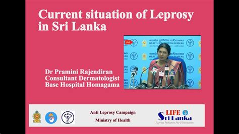 Current Situation Of Leprosy In Sri Lanka Tamil By Dr Premini