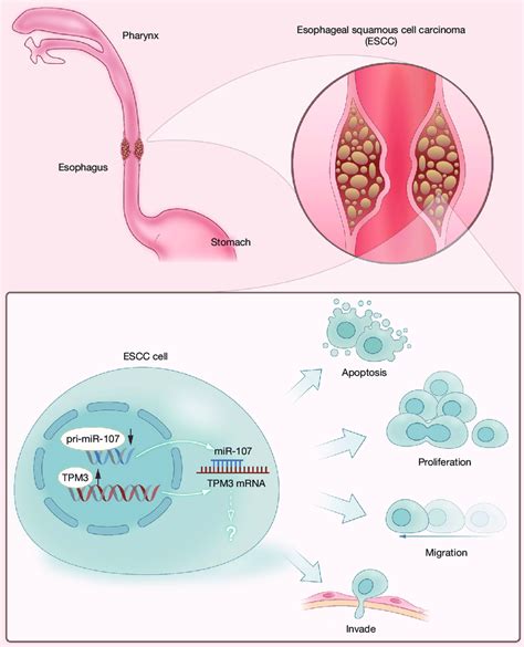 Diagram Of Mir 107 Inhibition Of Esophageal Squamous Carcinoma